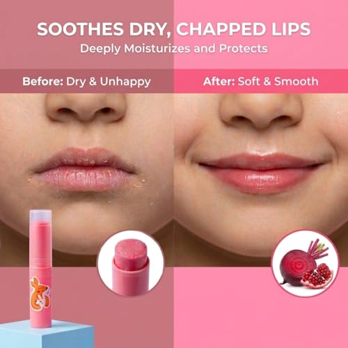 Mishmash Naturals Beetroot Lip Balm for Kids, Ages 3-14, 3g