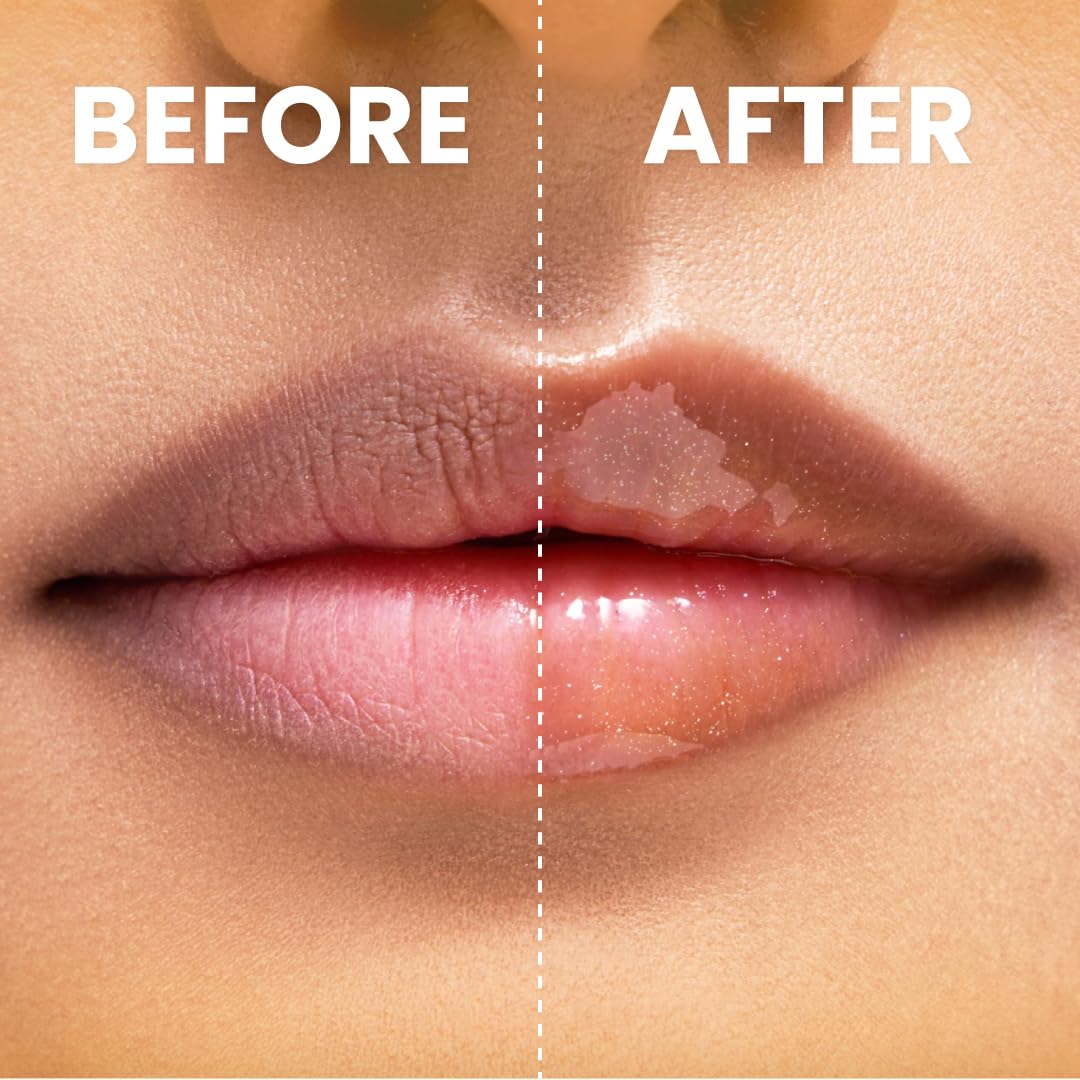 Typsy Beauty Hi Honey! SPF 25 Lip Oil| 7ml|Gloss like shine Enriched with Mirsalehi Honey & Vitamin E,PA+++ High UVA Protection |Zero Taste| Protects chapped lips with Metal Cooling Applicator