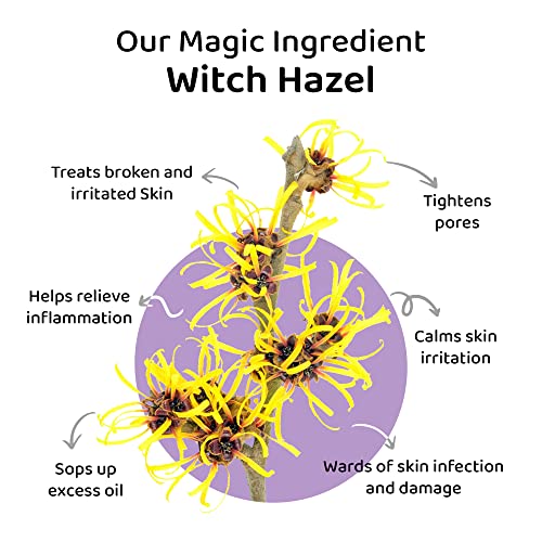 Elitty Jelly Lips- Pink Lip Gloss for High Shine, Glossy Finish & Hydrating Lips with Jajoba Oil & Vitamin E | Vegan & Cruelty-Free, Pretty Drip (4 ML) SaumyasStore